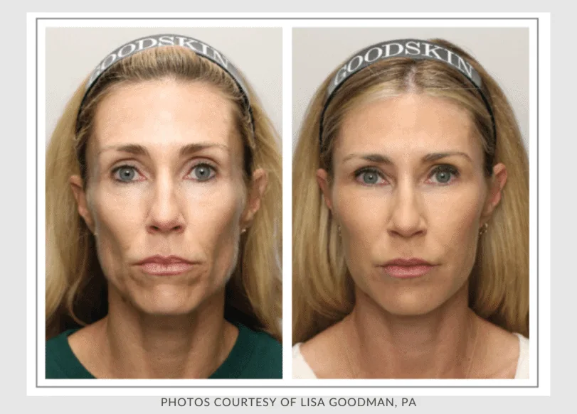 May Twentyfour Newsletter image six waestheticsandwellness In Bend OR