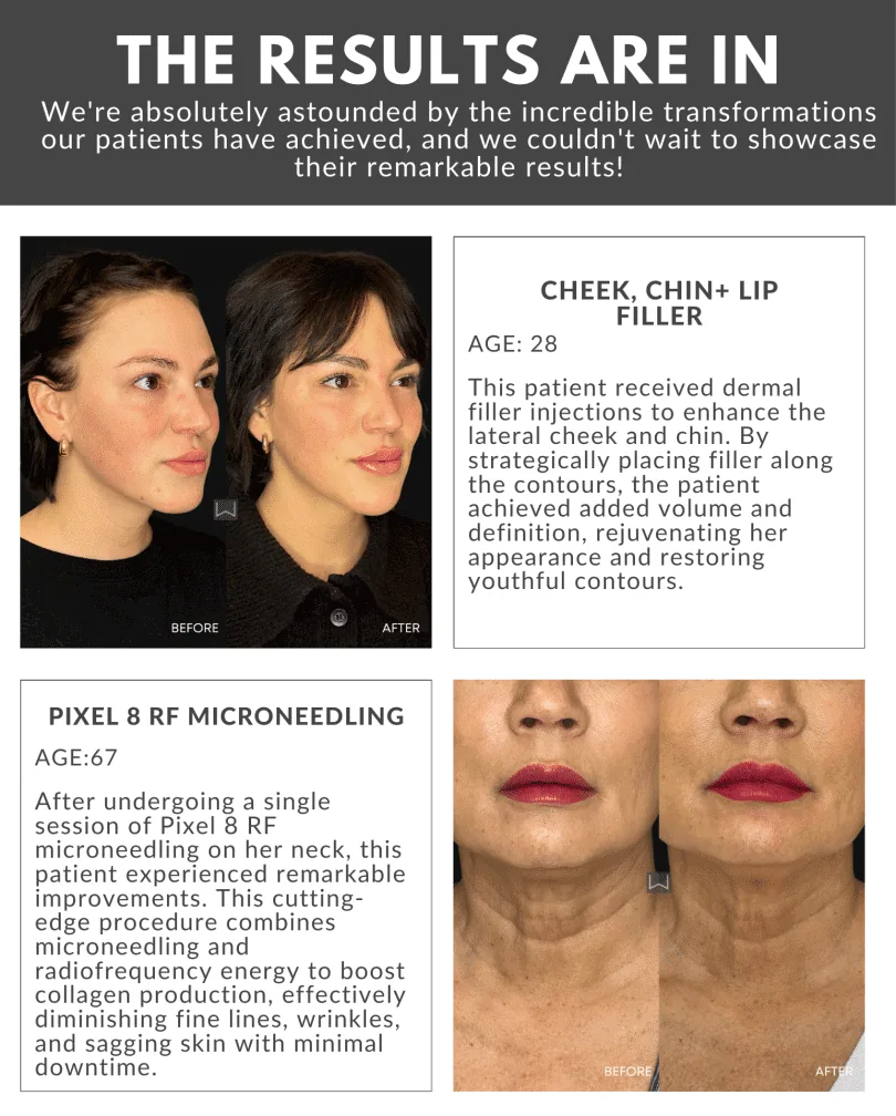 April Twentyfour Newsletter image eight waestheticsandwellness In Bend OR