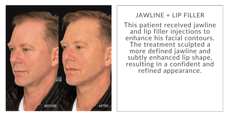 April Twentyfour Newsletter image nine waestheticsandwellness In Bend OR