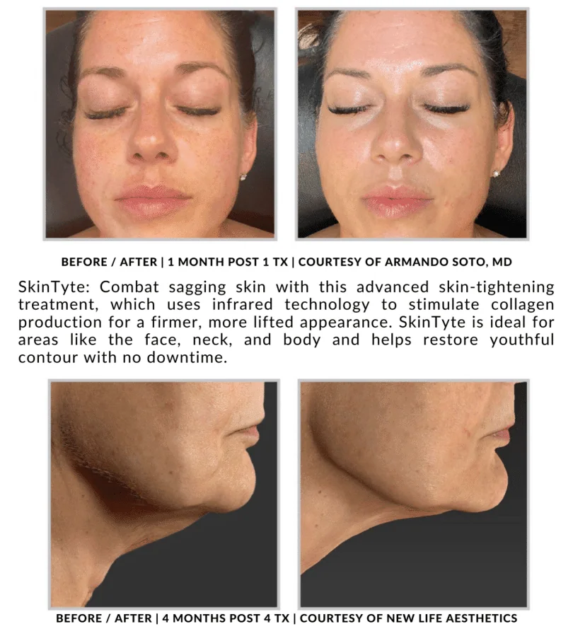 November Twentyfour Newsletter image four waestheticsandwellness In Bend OR