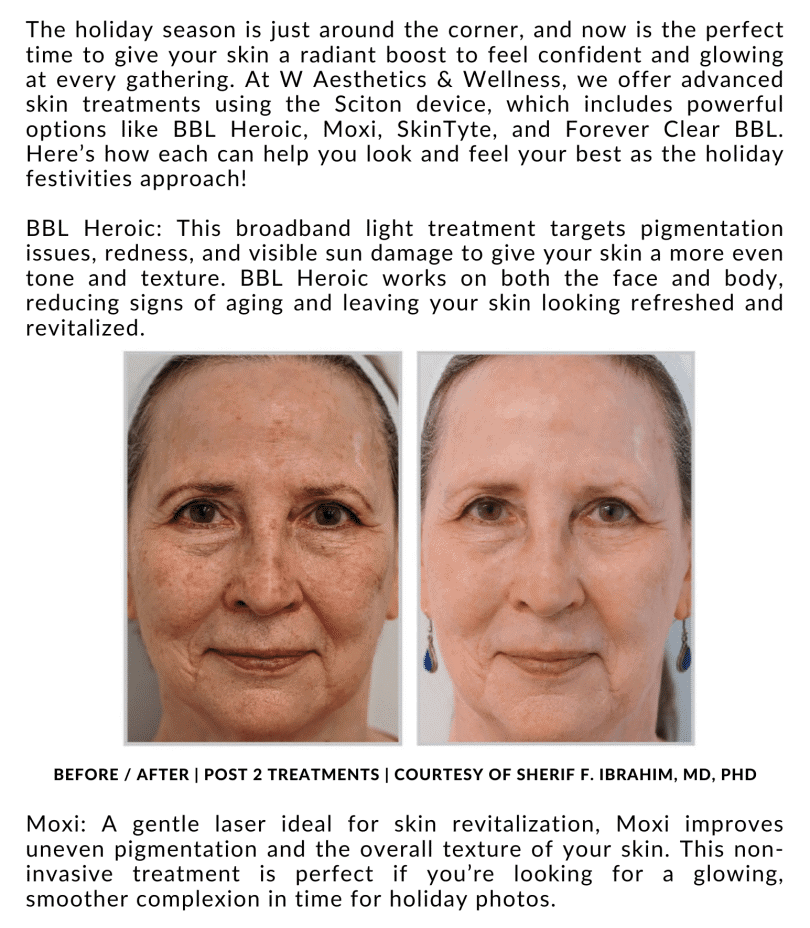 November Twentyfour Newsletter image three waestheticsandwellness In Bend OR