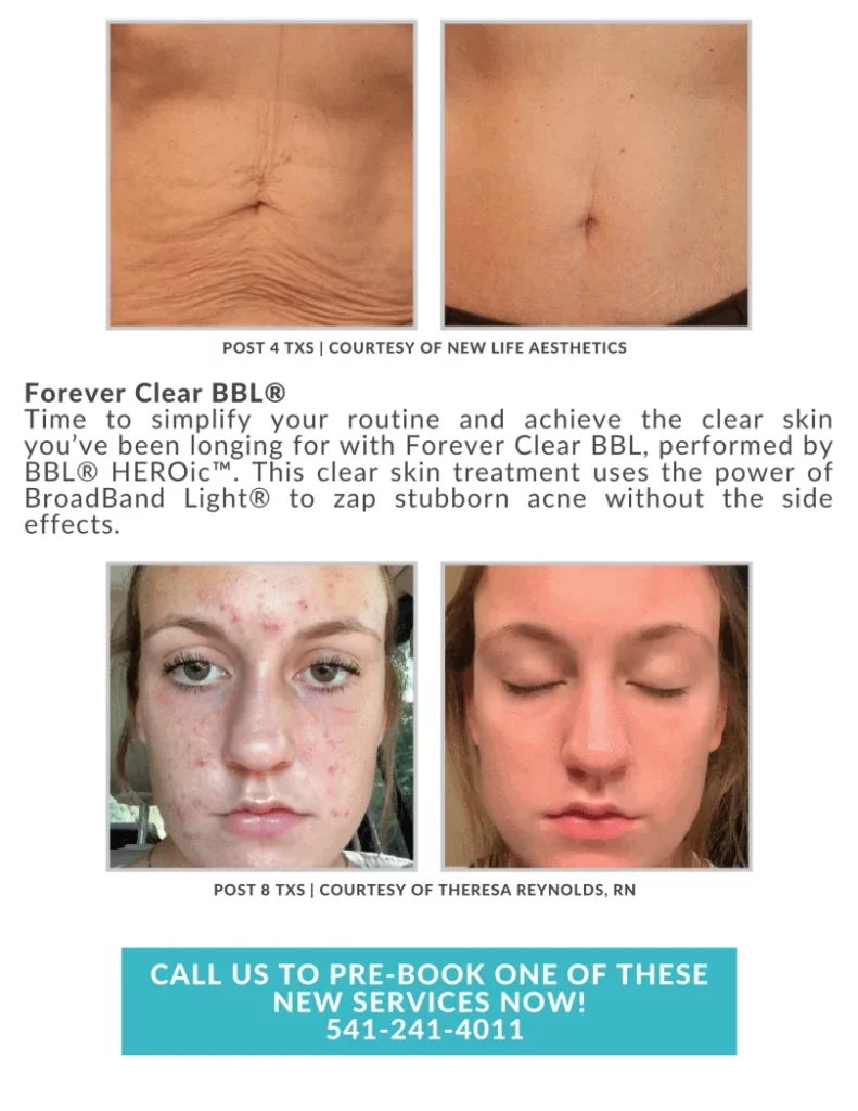 October Twentyfour Newsletter image three waestheticsandwellness In Bend OR