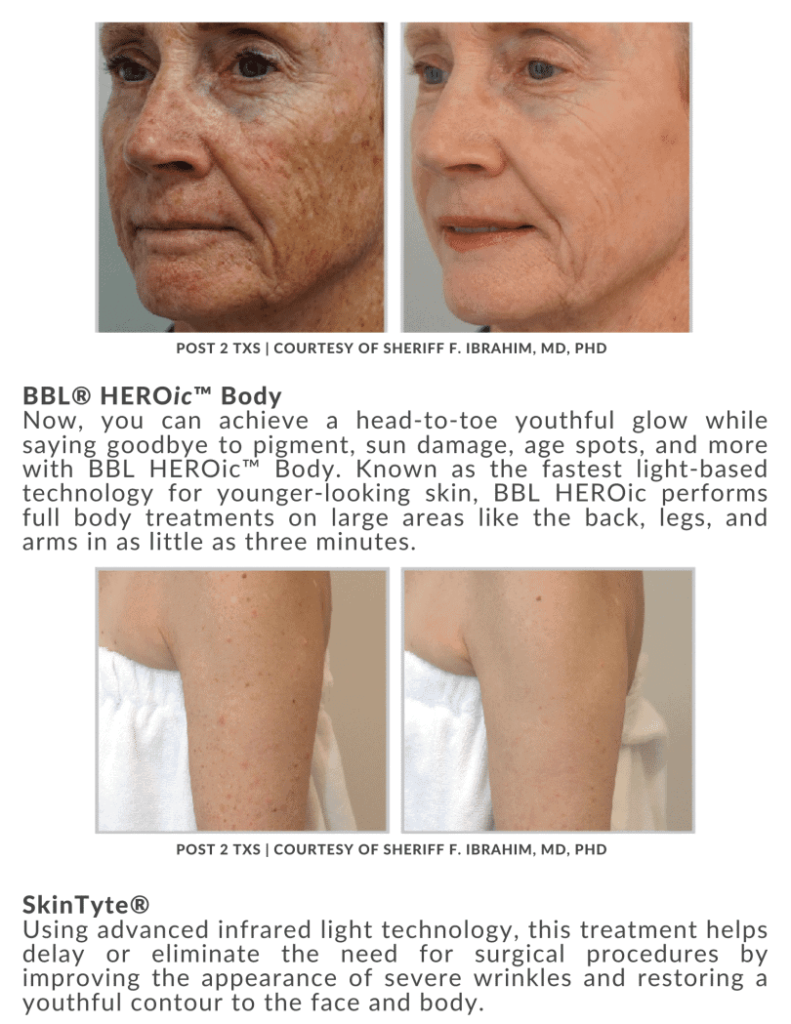 October Twentyfour Newsletter image two waestheticsandwellness In Bend OR