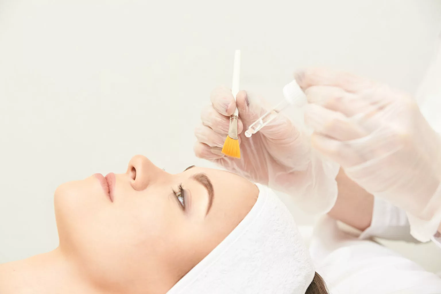 Blog 10 the mass appeal of the chemical peel