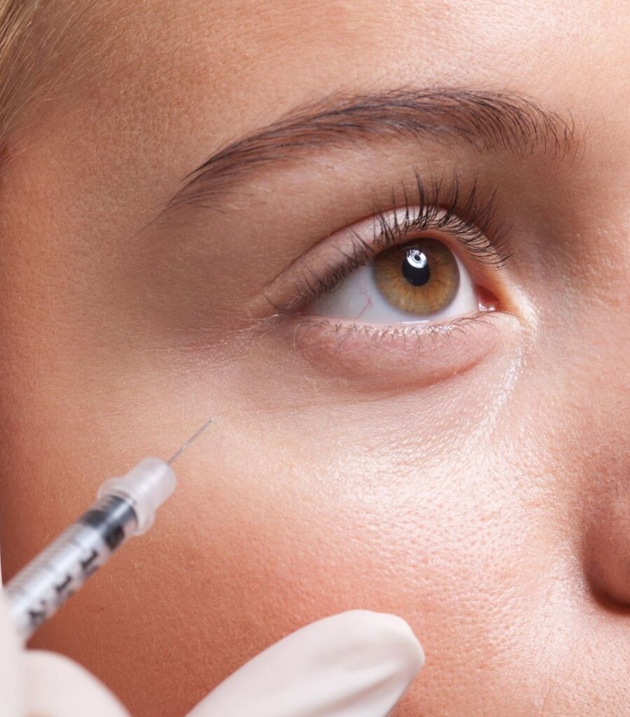 W_Aesthetics and Wellness Services PRF EZ Gel in Bend OR