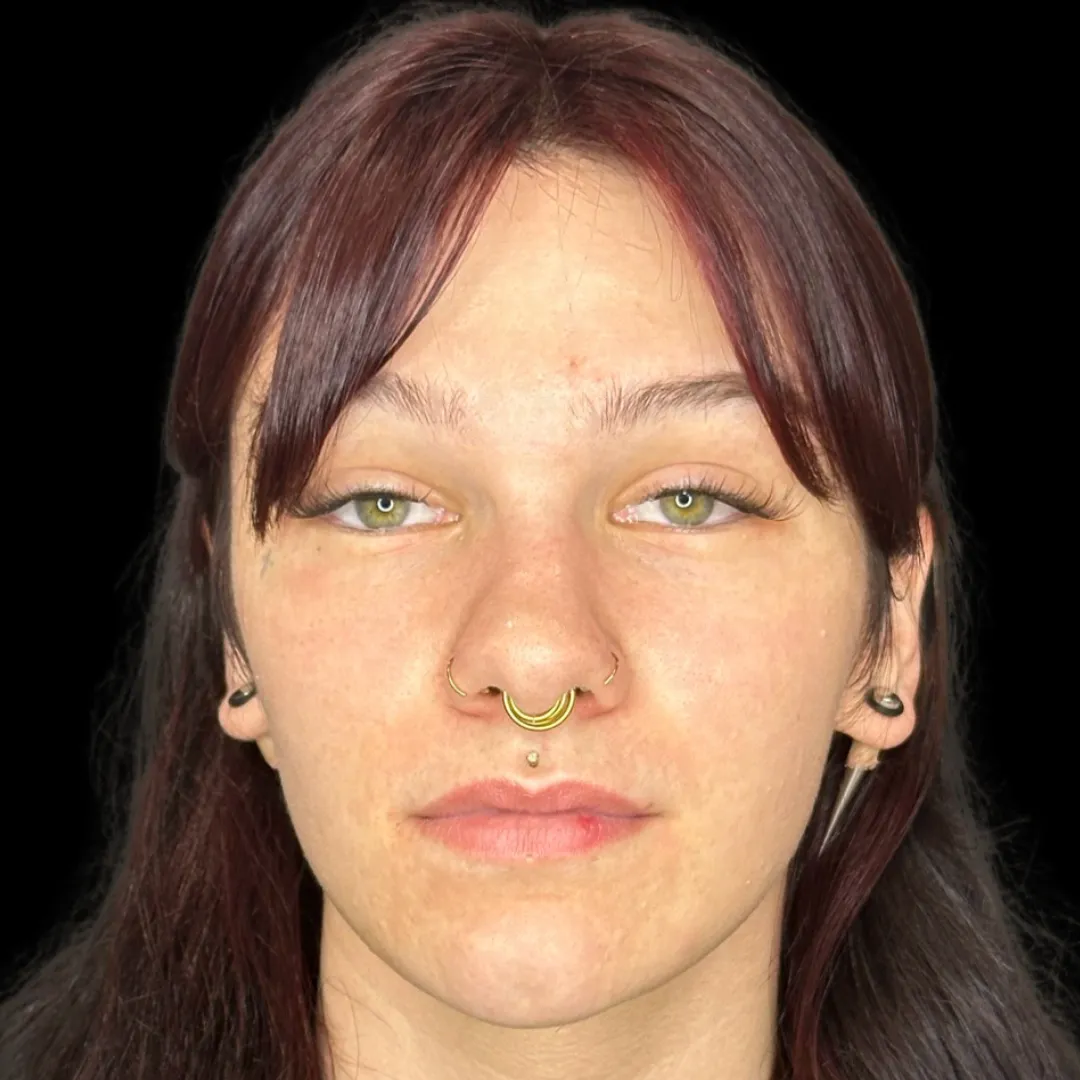 24