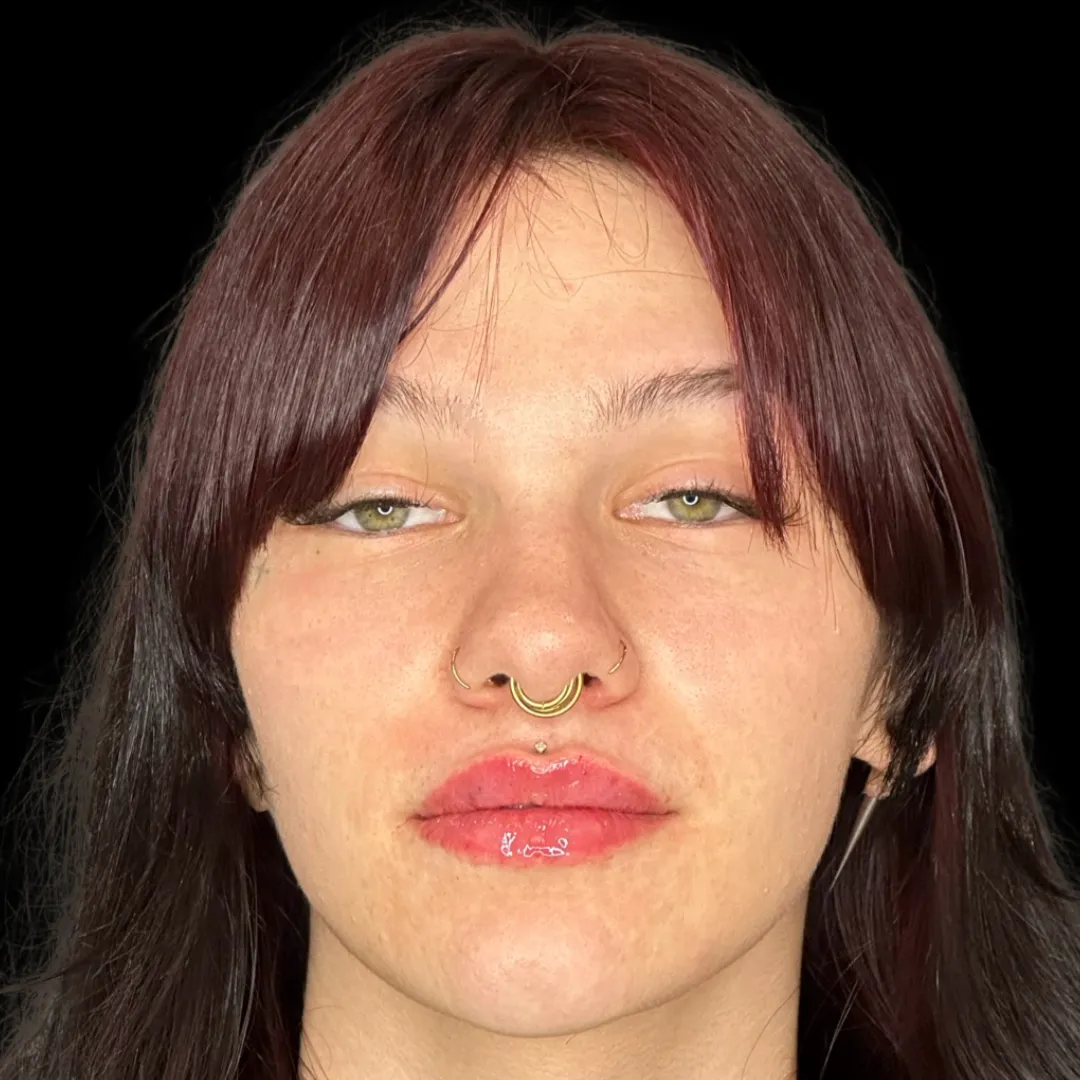 25