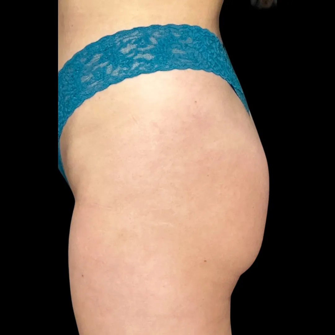54