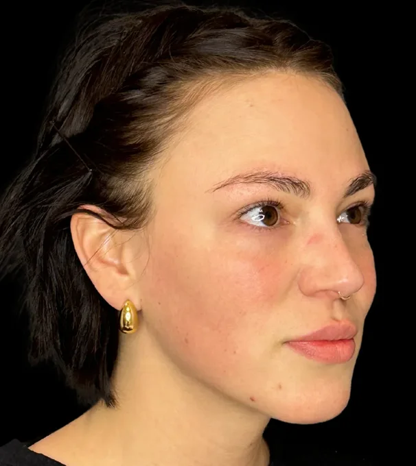 01-dermal-1