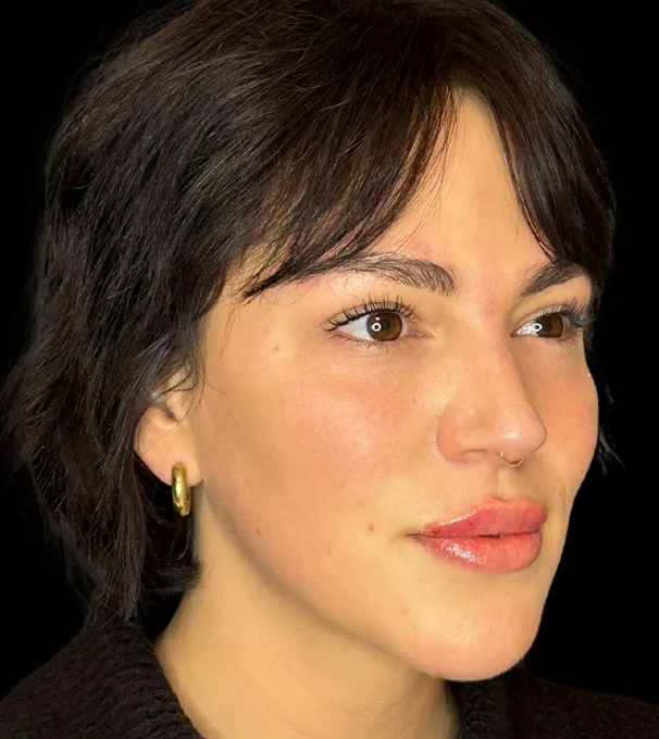 01-dermal-2